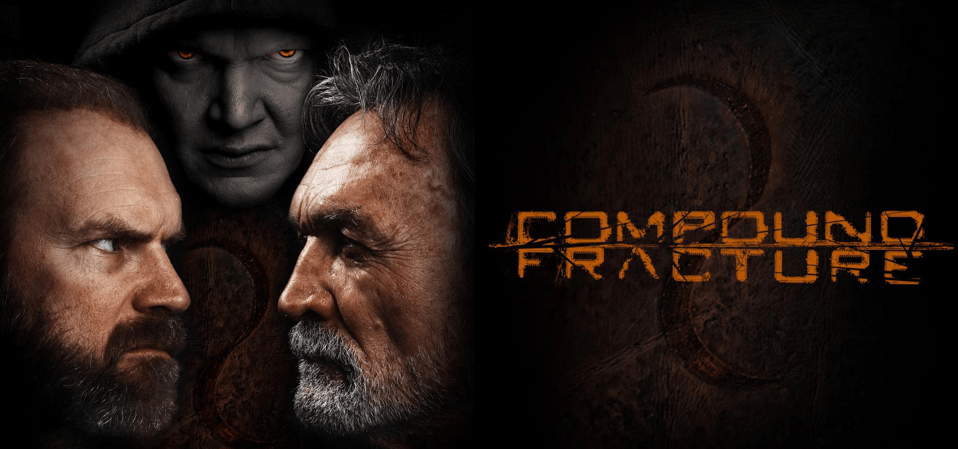 Compound Fracture